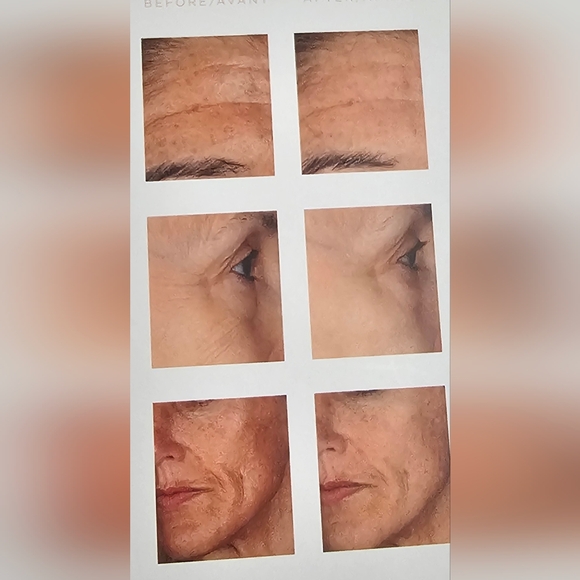 NWT BEAUTY BIO / Glo Pro Microneedling Regeneration Tool - Picture 6 of 6